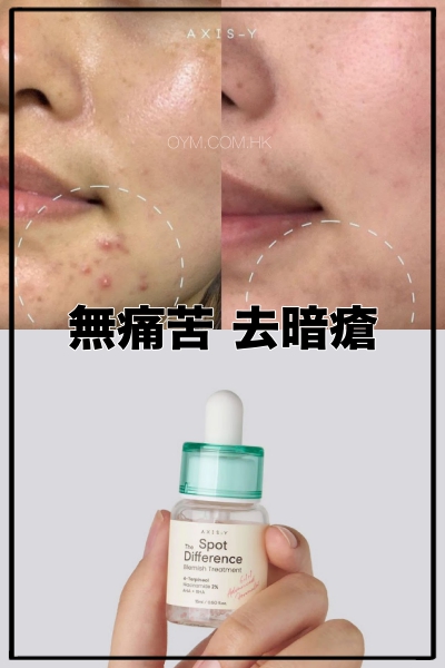 AXIS-Y 特效暗疮护理液 Spot The Disfference Blemish Treatment